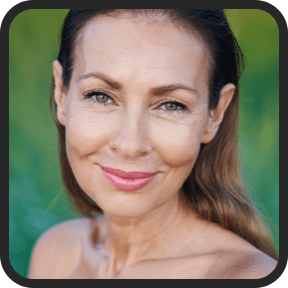 Derma Prime Plus Customer Testimonials